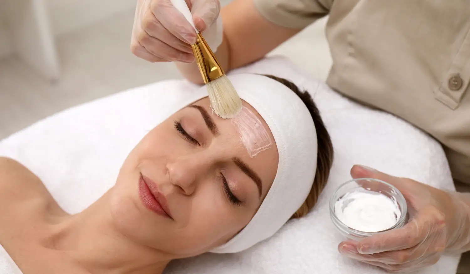 jenis-jenis chemical peel