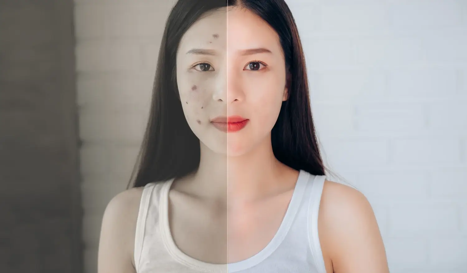 kandungan skincare untuk mencegah jerawat