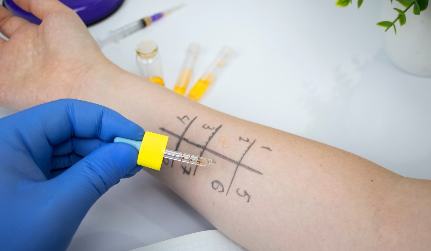 Pentingnya uji dermatologi